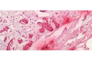Immunohistochemistry (IHC) image for anti-Tryptase alpha/beta 1 (TPSAB1) (AA 161-262) antibody (ABIN7426172)