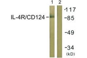 Western blot analysis of extracts from 293 cells, using IL-4R/CD124 (Ab-497) Antibody. (IL4 Receptor Antikörper  (AA 463-512))