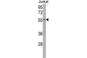 Western Blotting (WB) image for anti-Ubiquitin Specific Peptidase 22 (USP22) antibody (ABIN3001480) (USP22 Antikörper)