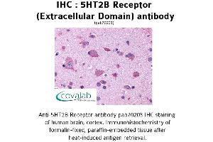 Image no. 1 for anti-Serotonin Receptor 2B (HTR2B) (2nd Extracellular Domain) antibody (ABIN1731363)