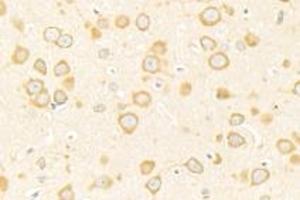 Immunohistochemistry analysis of paraffin-embedded rat prefrontal lobe using ADAMTS4 (ABIN7072947) at dilution of 1: 500