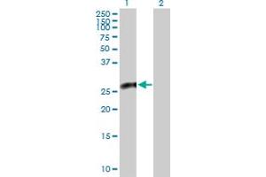 Western Blot analysis of CACYBP expression in transfected 293T cell line by CACYBP MaxPab polyclonal antibody. (CACYBP Antikörper  (AA 1-228))