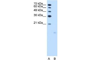 WB Suggested Anti-PPFIBP1 Antibody Titration:  2. (PPFIBP1 Antikörper  (N-Term))