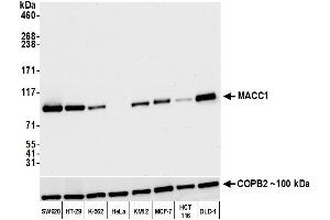 Western Blotting (WB) image for anti-Metastasis Associated in Colon Cancer 1 (MACC1) (AA 100-150) antibody (ABIN7453975)