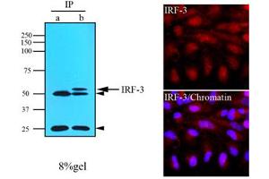 Immunofluorescence of human HeLa cells stained with IRF-3 (1:500) with Texas-Red and Hoechst 33342 (Blue) for nucleus staining. (IRF3 Antikörper  (AA 108-166))