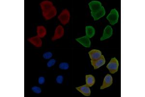 ABIN6261940 and ABIN6276315 staining Hela cells(30 min of UV treatment) by IF/ICC.