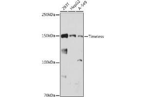 Western blot analysis of extracts of various cell lines, using Timeless antibody (ABIN1682797, ABIN7101315, ABIN7101316 and ABIN7101317) at 1:1000 dilution.