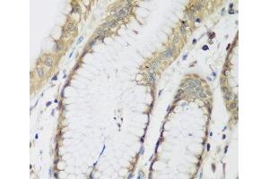Immunohistochemistry of paraffin-embedded Human stomach using METTL7A Polyclonal Antibody at dilution of 1:200 (40x lens). (METTL7A Antikörper)