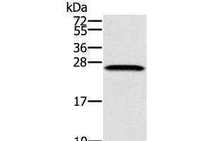 Western Blot analysis of K562 cell using SSX1 Polyclonal Antibody at dilution of 1:400