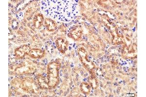 Paraformaldehyde-fixed, paraffin embedded Mouse Kidney tissue, Antigen retrieval by boiling in sodium citrate buffer(pH6) for 15min, Block endogenous peroxidase by 3% hydrogen peroxide for 20 minutes, Blocking buffer (normal goat serum) at 37°C for 30min, Antibody incubation with KRAS Polyclonal Antibody, Unconjugated  at 1:400 overnight at 4°C, followed by a conjugated secondary and DAB staining (K-RAS Antikörper  (AA 25-130))