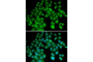 Immunofluorescence (IF) image for anti-Thymosin beta-4 (TMSB4X) antibody (ABIN1876626) (TMSB4X Antikörper)