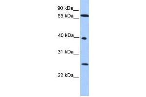 Human HeLa; WB Suggested Anti-L3MBTL2 Antibody Titration: 0.