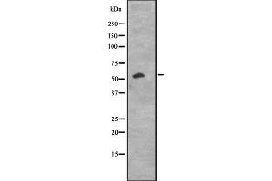 Western blot analysis of CCNK expression in K562 cell lysate ;,The lane on the left is treated with the antigen-specific peptide.