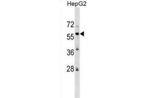 Western Blotting (WB) image for anti-Zinc finger protein 82 homolog (ZFP82) antibody (ABIN2999761)