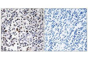Immunohistochemistry (IHC) image for anti-CD302 (CD302) (Internal Region) antibody (ABIN1850248) (DCL1 Antikörper  (Internal Region))