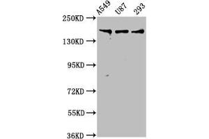 Western Blot Positive WB detected in: A549 whole cell lysate, U87 whole cell lysate, 293 whole cell lysate All lanes: AGRN antibody at 7. (AGRN Antikörper  (AA 968-1130))
