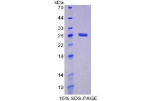 SDS-PAGE (SDS) image for Damage-Specific DNA Binding Protein 2, 48kDa (DDB2) (AA 212-407) protein (His tag) (ABIN1879711) (DDB2 Protein (AA 212-407) (His tag))