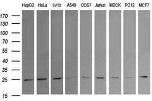 Image no. 2 for anti-RAB21, Member RAS Oncogene Family (RAB21) antibody (ABIN1500548) (RAB21 Antikörper)