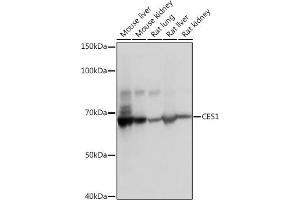 Western blot analysis of extracts of various cell lines, using CES1 Rabbit mAb (ABIN7266077) at 1:1000 dilution.
