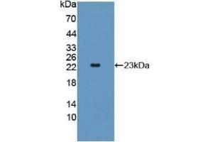 Detection of Recombinant AK2, Rat using Polyclonal Antibody to Adenylate Kinase 2 (AK2) (Adenylate Kinase 2 Antikörper  (AA 64-232))