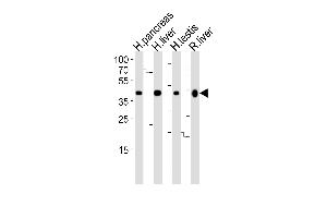 Western blot analysis of lysates from human pancreas, liver, testis and rat liver tissue lysate (from left to right), using HMGCS2 Antibody (C-term) (ABIN390764 and ABIN2841022).