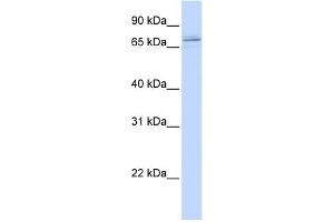 WB Suggested Anti-MAK Antibody Titration:  0. (MAK Antikörper  (C-Term))