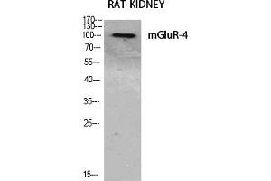 Western Blot analysis of various cells using mGluR-4 Polyclonal Antibody diluted at 1:500. (Metabotropic Glutamate Receptor 4 Antikörper  (AA 820-900))