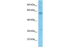 Host:  Rabbit  Target Name:  SLCO2B1  Sample Tissue:  Human Hela Whole Cell  Antibody Dilution:  1ug/ml (SLCO2B1 Antikörper  (N-Term))