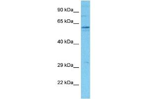 Western Blotting (WB) image for anti-Solute Carrier Organic Anion Transporter Family, Member 2B1 (SLCO2B1) (N-Term) antibody (ABIN2781627)