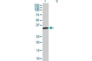 Western Blotting (WB) image for anti-Protein Kinase, Interferon-Inducible Double Stranded RNA Dependent Activator (PRKRA) (AA 1-313) antibody (ABIN1327667)