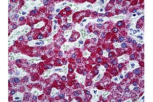 Anti-CPS1 antibody IHC of human liver. (CPS1 Antikörper  (AA 1400-1501))