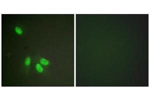 Immunofluorescence analysis of HeLa cells, using hnRPD (epitope around residue 83) antibody. (HNRNPD/AUF1 Antikörper  (Ser83))