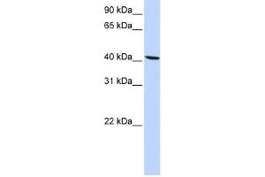 WB Suggested Anti-SLC22A18 Antibody Titration:  0.