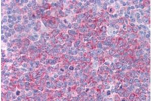 Immunohistochemistry (Formalin-fixed Paraffin-embedded Sections) (IHC (fp)) image for anti-Heat Shock Protein 90kDa alpha (Cytosolic), Class A Member 1 (HSP90AA1) (AA 108-157) antibody (ABIN6745698)