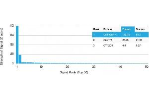 Analysis of Protein Array containing more than 19,000 full-length human proteins using Cathepsin K Mouse Monoclonal Antibody (CTSK/2792) Z- and S- Score: The Z-score represents the strength of a signal that a monoclonal antibody (Monoclonal Antibody) (in combination with a fluorescently-tagged anti-IgG secondary antibody) produces when binding to a particular protein on the HuProtTM array.