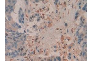 Immunohistochemistry (IHC) image for anti-Mechanistic Target of Rapamycin (serine/threonine Kinase) (mTOR) (AA 2226-2488) antibody (ABIN7440680)