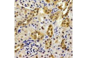 Immunohistochemical analysis of PSMB9 staining in mouse kidney formalin fixed paraffin embedded tissue section. (PSMB9 Antikörper)