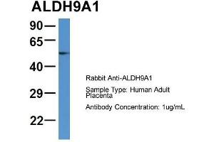 Host: Rabbit  Target Name: ALDH9A1  Sample Tissue: Human Adult Placenta  Antibody Dilution: 1.