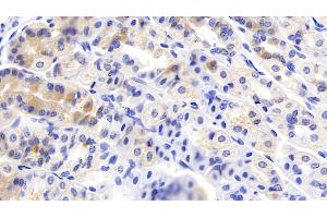 Immunohistochemistry (IHC) image for anti-Hepatocyte Growth Factor (Hepapoietin A, Scatter Factor) (HGF) (AA 482-710) antibody (ABIN7430567)
