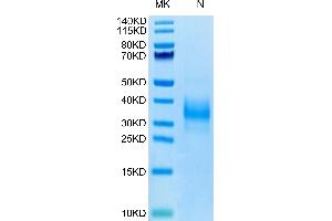 Biotinylated Human SOST on Tris-Bis PAGE under reduced condition. (Sclerostin Protein (SOST) (AA 24-213) (His-Avi Tag,Biotin))