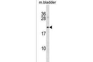 Rat Mycb Antibody (C-term) (ABIN1536682 and ABIN2850194) western blot analysis in mouse bladder tissue lysates (35 μg/lane). (Protein B-Myc Antikörper  (C-Term))