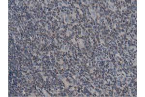 Immunohistochemical staining of paraffin-embedded Human lymph node tissue using anti-DNAJA2 mouse monoclonal antibody. (DNAJA2 Antikörper)