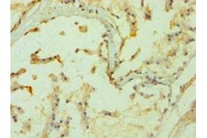 Immunohistochemistry of paraffin-embedded human prostate tissue using ABIN7169286 at dilution of 1:100 (PPP3CC Antikörper  (Catalytic Subunit gamma))