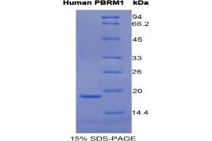 SDS-PAGE analysis of Human Polybromo 1 Protein. (Polybromo 1 Protein (PBRM1))