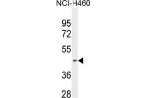 Western Blotting (WB) image for anti-Pyruvate Dehydrogenase (Lipoamide) alpha 2 (PDHa2) antibody (ABIN2995821) (PDHA2 Antikörper)