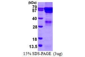Image no. 1 for Regulator of G-Protein Signaling 14 (RGS14) protein (His tag) (ABIN6386992) (RGS14 Protein (His tag))