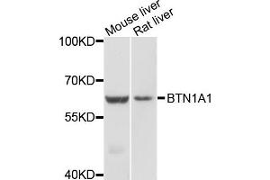 Western blot analysis of extracts of mouse liver and rat liver cells, using BTN1A1 antibody.
