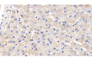 Detection of IL5 in Canine Liver Tissue using Polyclonal Antibody to Interleukin 5 (IL5)