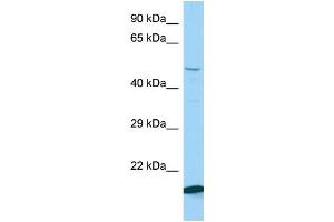 Host: Rabbit Target Name: Kbtbd2 Sample Type: Mouse Testis lysates Antibody Dilution: 1. (KBTBD2 Antikörper  (N-Term))