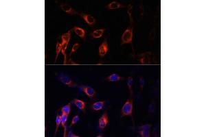 Immunofluorescence analysis of NIH-3T3 cells using TSC1 Polyclonal Antibody (ABIN6133755, ABIN6149609, ABIN6149610 and ABIN6213968) at dilution of 1:100 (40x lens). (TSC1 Antikörper  (AA 550-650))